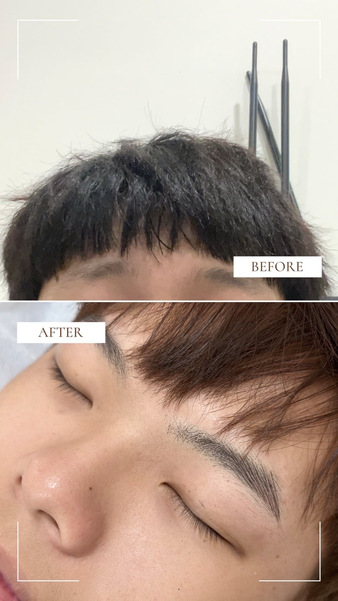 霧眉前後對比照片
