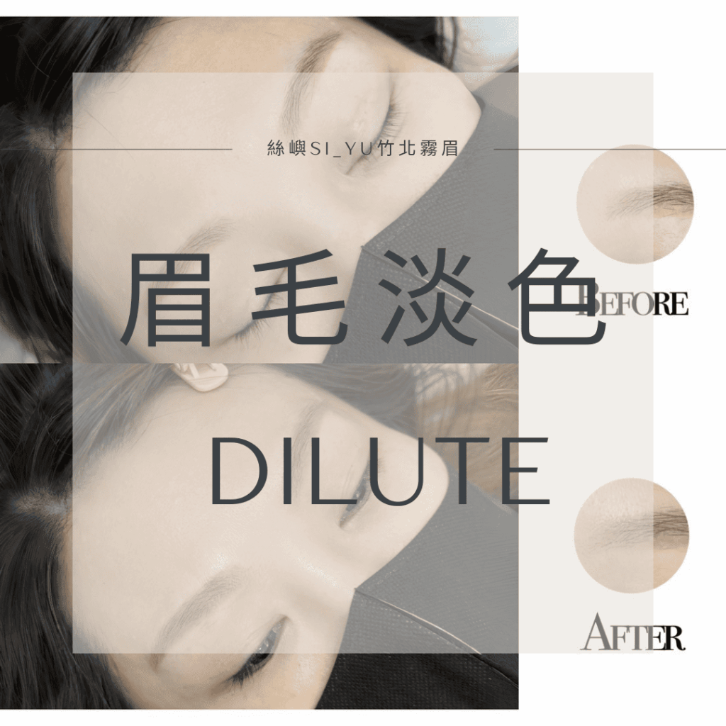 眉毛除色案例分享照片